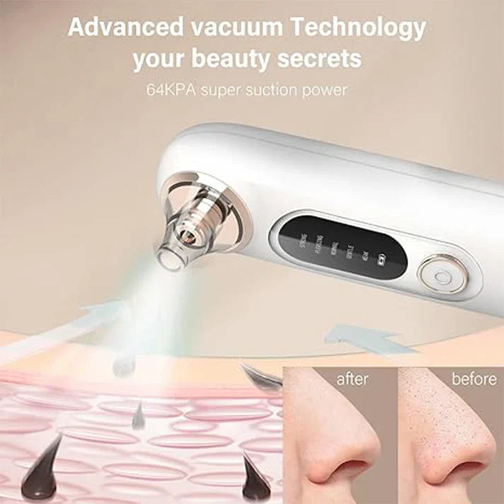 PureLift Pore Cleaner